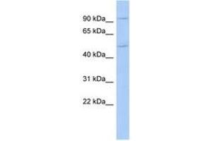 Image no. 1 for anti-Mastermind-Like Domain Containing 1 (MAMLD1) (AA 143-192) antibody (ABIN6742444) (MAMLD1 antibody  (AA 143-192))