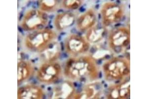 Used in DAB staining on fromalin fixed paraffin-embedded Kidney tissue (PAFAH1B3 antibody  (AA 1-232))
