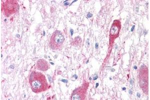 Anti-GRM5 / MGLUR5 antibody  ABIN1048938 IHC staining of human brain, neurons and glia.