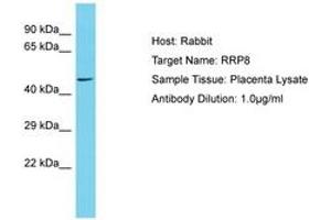 Image no. 1 for anti-Ribosomal RNA Processing 8 (RRP8) (AA 100-149) antibody (ABIN6750590) (RRP8 antibody  (AA 100-149))