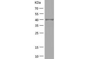Western Blotting (WB) image for Alcohol Dehydrogenase (ADH) (AA 1-375) protein (His tag) (ABIN7121765) (Alcohol Dehydrogenase (ADH) (AA 1-375) protein (His tag))