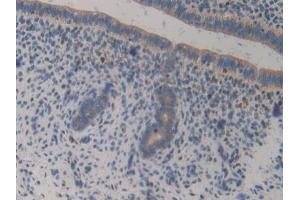 Detection of GAB3 in Mouse Uterus Tissue using Polyclonal Antibody to GRB2 Associated Binding Protein 3 (GAB3) (GAB3 antibody  (AA 142-375))