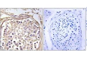 Immunohistochemistry analysis of paraffin-embedded human testis tissue, using CHST9 Antibody. (CHST9 antibody  (AA 361-410))