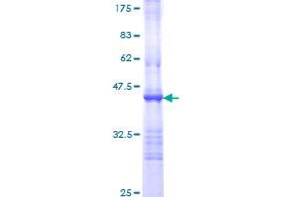 TLR5 Protein (AA 517-634) (GST tag)