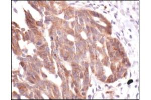 Immunohistochemistry (IHC) image for anti-Matrix Metallopeptidase 9 (Gelatinase B, 92kDa Gelatinase, 92kDa Type IV Collagenase) (MMP9) antibody (ABIN953467)