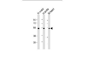 All lanes : Anti-VEGF3 Antibody at 1:2000 dilution Lane 1: human ovary lysate Lane 2: human testis lysate Lane 3: mouse heart lysate Lysates/proteins at 20 μg per lane. (VEGFC antibody  (C-Term, N-Term))