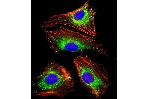 Immunofluorescent analysis of 4% paraformaldehyde-fixed, 0. (LAMP1 antibody)
