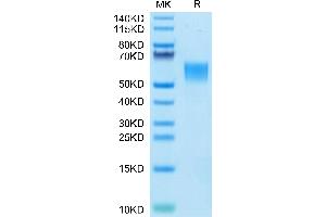 ENPP3 Protein (AA 558-875) (His tag)