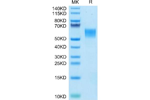 ENPP3 Protein (AA 558-875) (His tag)