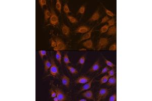 Immunofluorescence analysis of C6 cells using SEL1L antibody (ABIN6132642, ABIN6147499, ABIN6147500 and ABIN6215644) at dilution of 1:100.