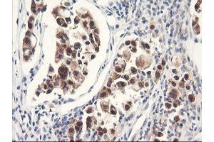 Image no. 5 for anti-F-Box Protein 21 (FBXO21) antibody (ABIN1498231) (FBXO21 antibody)