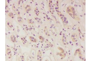 Formalin-fixed and paraffin embedded human kidney labeled with Anti-IFNAR1 Polyclonal Antibody, Unconjugated  at 1:300 followed by conjugation to the secondary antibody and DAB staining. (IFNAR1 antibody  (AA 351-450))