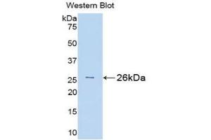 Detection of Recombinant Bid, Rat using Polyclonal Antibody to BH3 Interacting Domain Death Agonist (Bid) (BID antibody  (AA 1-196))