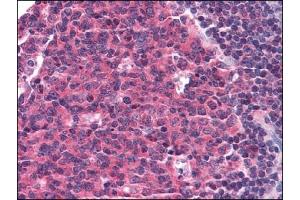 Immunohistochemistry (IHC) image for anti-Chemokine (C-C Motif) Receptor 5 (CCR5) antibody (ABIN614398) (CCR5 antibody)