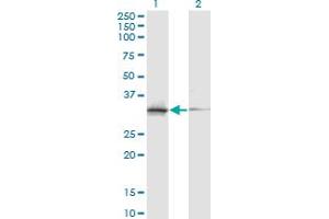 Western Blot analysis of ASRGL1 expression in transfected 293T cell line by ASRGL1 monoclonal antibody (M03A), clone 5C8. (ASRGL1 antibody  (AA 1-180))