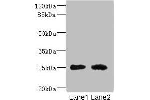 Western blot All lanes: CEACAM4 antibody at 1. (CEACAM4 antibody  (AA 36-155))