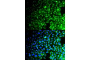 Immunofluorescence analysis of A549 cell using USP10 antibody. (USP10 antibody)