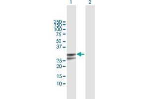 Western Blot analysis of PPP1R2P3 expression in transfected 293T cell line by PPP1R2P3 MaxPab polyclonal antibody. (PPP1R2P3 antibody  (AA 1-205))