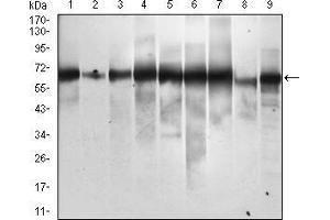 Western blot analysis using SQSTM1 mouse mAb against Hela (1), Jurkat (2), THP-1 (3), HEK293 (4), A549 (5), MCF-7 (6), HepG2 (7), COS7 (8) and SK-BR-3 (9) cell lysate. (SQSTM1 antibody  (AA 232-356))