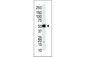 Western blot analysis of anti-mDnmt2 Pab (ABIN387906 and ABIN2844280) in HL-60 cell lysate. (Dnmt2 antibody  (N-Term))