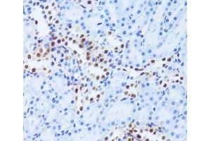 Immunohistochemistry of paraffin-embedded Rat kidney using ANP32A Polyclonal Antibody at dilution of 1:100 (40x lens). (PHAP1 antibody)