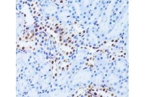 Immunohistochemistry of paraffin-embedded Rat kidney using ANP32A Polyclonal Antibody at dilution of 1:100 (40x lens). (PHAP1 antibody)