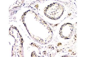anti-Doublesex and Mab-3 Related Transcription Factor 1 (DMRT1) (AA 98-128), (N-Term) antibody