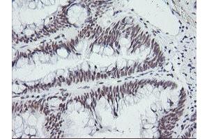 Image no. 1 for anti-SEC14 and Spectrin Domains 1 (SESTD1) antibody (ABIN1501066) (SESTD1 antibody)
