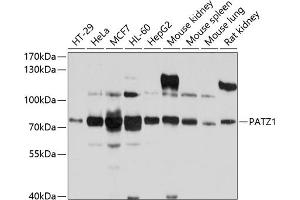 Western blot analysis of extracts of various cell lines, using P antibody (ABIN6132856, ABIN6145252, ABIN6145253 and ABIN6214168) at 1:1000 dilution. (PATZ1 antibody  (AA 250-350))