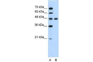 Western Blot showing HSPBAP1 antibody used at a concentration of 1-2 ug/ml to detect its target protein. (HSPBAP1 antibody  (C-Term))