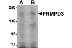 Western blot analysis of FRMPD3 in Jurkat cell lysate with AP30348PU-N FRMPD3 antibody at (A) 1 and (B) 2 μg/ml.