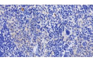 Detection of GPX1 in Mouse Spleen Tissue using Polyclonal Antibody to Glutathione Peroxidase 1 (GPX1) (Glutathione Peroxidase 1 antibody  (AA 48-201))
