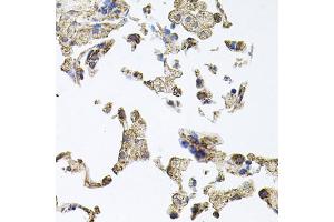 Immunohistochemistry of paraffin-embedded human lung using PKN1 antibody. (PKN1 antibody)