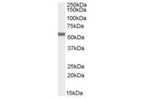 Image no. 2 for anti-Forkhead Box C1 (FOXC1) (C-Term) antibody (ABIN374336) (FOXC1 antibody  (C-Term))