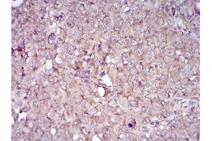 Immunohistochemistry (IHC) image for anti-CD38 (AA 43-300) antibody (ABIN5542494)