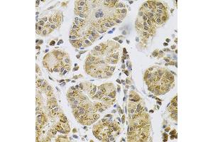 Immunohistochemistry of paraffin-embedded human stomach using PSEN1 Antibody (ABIN5971213) at dilution of 1/100 (40x lens). (Presenilin 1 antibody)