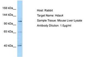 Image no. 1 for anti-Histone Deacetylase 4 (HDAC4) (C-Term) antibody (ABIN6749909) (HDAC4 antibody  (C-Term))