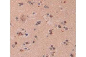 IHC-P analysis of Human Tissue, with DAB staining. (PIN4 antibody  (AA 23-130))
