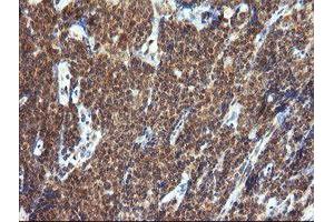 Image no. 2 for anti-Tripartite Motif Containing 44 (TRIM44) antibody (ABIN1501505) (TRIM44 antibody)