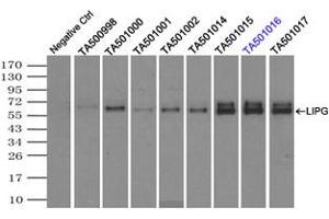 Image no. 6 for anti-Lipase, Endothelial (LIPG) antibody (ABIN1499163)