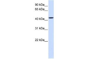 NIPA2 antibody used at 1 ug/ml to detect target protein. (NIPA2 antibody  (Middle Region))