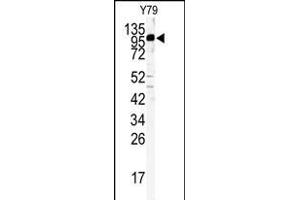 Western blot analysis of KIF3C antibody (C-term) (ABIN391675 and ABIN2841586) in Y79 cell line lysates (35 μg/lane). (KIF3C antibody  (C-Term))