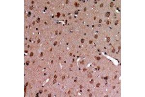 Immunohistochemical analysis of TYRO3/MERTK (pY749/681) staining in human brain formalin fixed paraffin embedded tissue section. (MerTK/Tyro3 antibody  (C-Term, pTyr681, pTyr749))