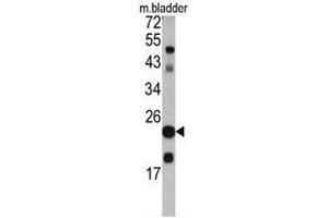 Western blot analysis of TAGLN antibody (C-term) in mouse bladder tissue lysates (35ug/lane).