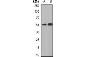Western blot analysis of MGAT1 expression in human liver (A), human gastric (B) whole cell lysates. (MGAT1 antibody)