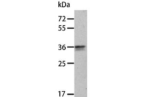 Western Blot analysis of A549 cell using ANXA8 Polyclonal Antibody at dilution of 1:300 (Annexin VIII antibody)