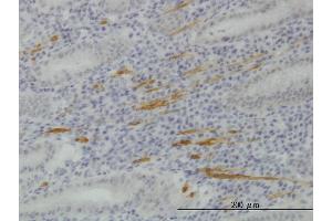 Immunoperoxidase of monoclonal antibody to SMURF1 on formalin-fixed paraffin-embedded human stomach. (SMURF1 antibody  (AA 165-268))
