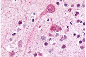 Anti-BDKRB2 / BK-2 antibody  ABIN1048349 IHC staining of human brain, neurons and glia. (BDKRB2 antibody  (C-Term))