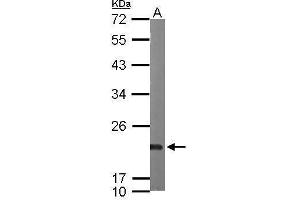 WB Image Sample (50 ug of whole cell lysate) A: mouse heart 12% SDS PAGE antibody diluted at 1:1000 (SRI antibody)