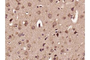 Paraformaldehyde-fixed, paraffin embedded mouse brain, Antigen retrieval by boiling in sodium citrate buffer (pH6) for 15min, Block endogenous peroxidase by 3% hydrogen peroxide for 30 minutes, Blocking buffer (normal goat serum) at 37°C for 20min, Antibody incubation with ELOVL2 Polyclonal Antibody  at 1:400 overnight at 4°C, followed by a conjugated secondary and DAB staining. (ELOVL2 antibody  (AA 201-296))